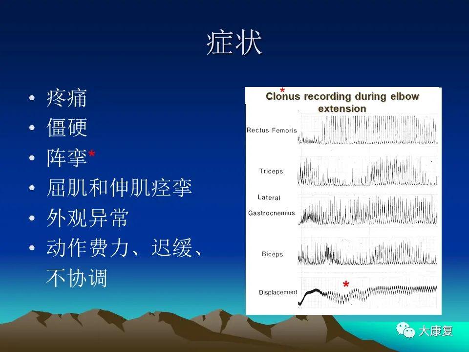 关于性痉挛的正确理解与相关信息下载注意事项（敏感话题，请谨慎处理）